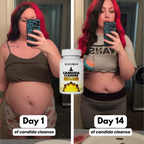 Candida Cleanse Gut & Colon Support