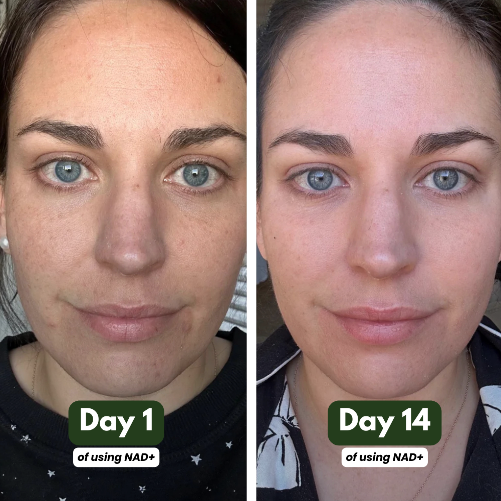 NAD+ Supplement for Skin Aging Support