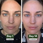 NAD+ Supplement for Skin Aging Support