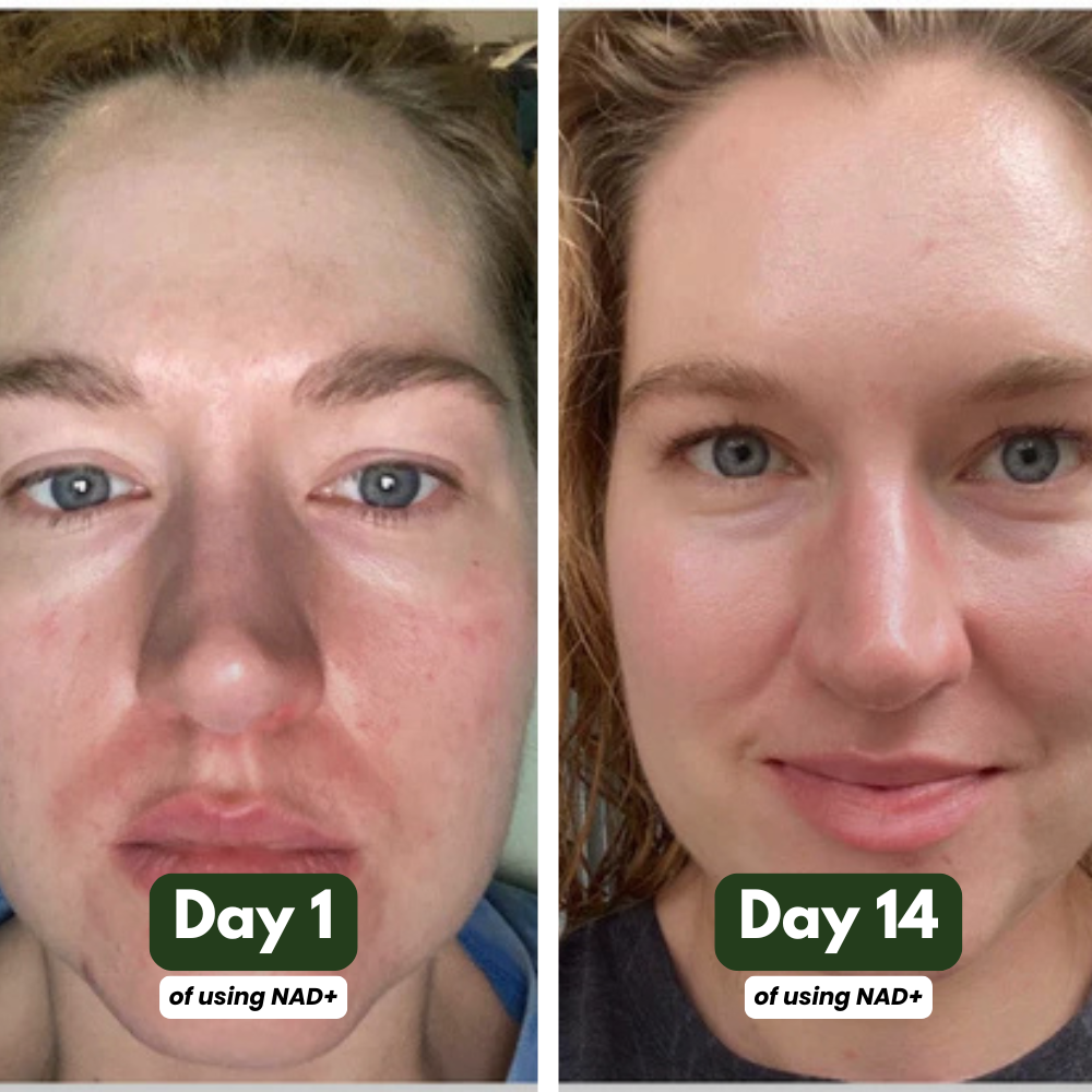 NAD+ Supplement for Skin Aging Support