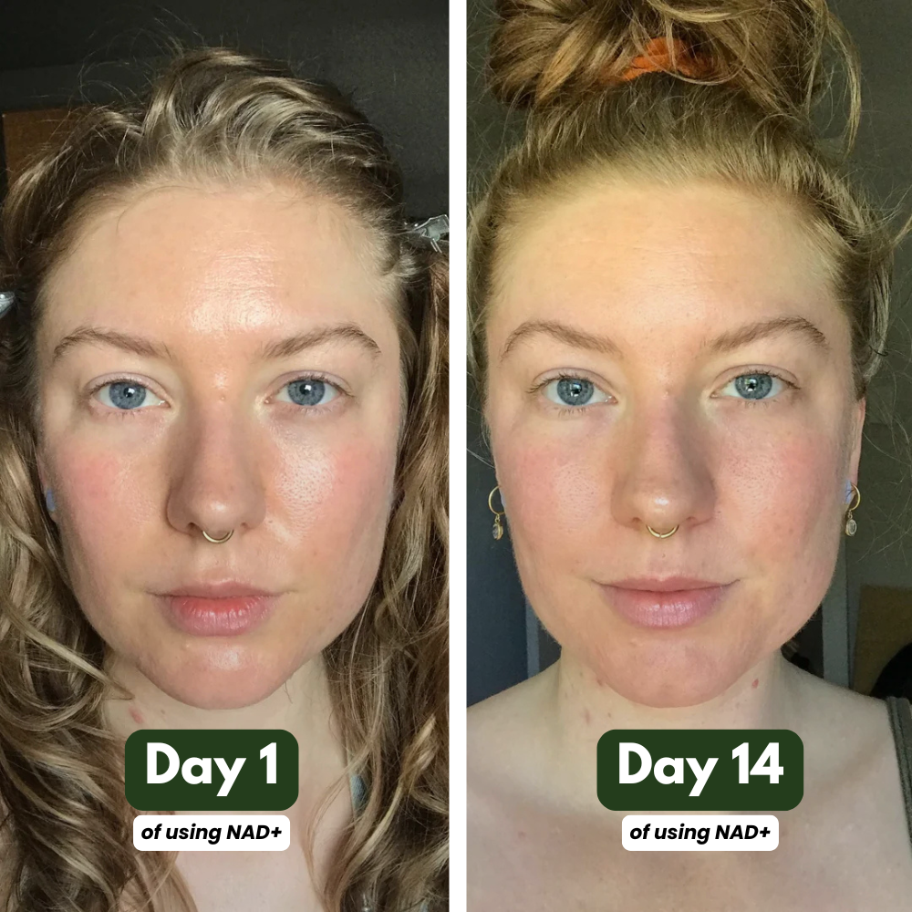 NAD+ Supplement for Skin Aging Support