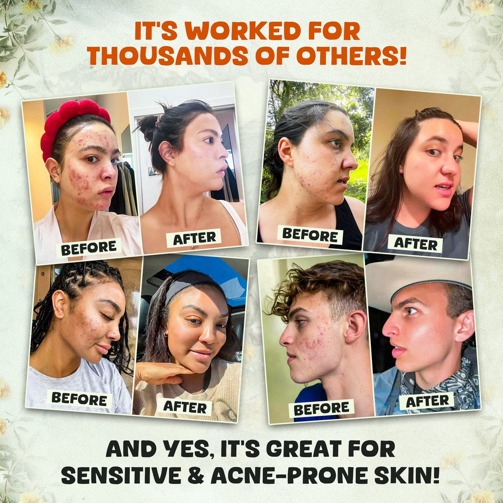 Whipped Beef Tallow with Honey Balm